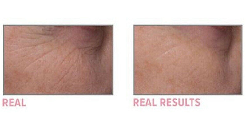 Super Moisturizing Anti-Wrinkle Cream